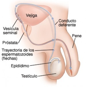 Vasectomía en clínica Valencia